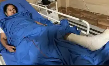बंगाल : ममता दीदी के बाएं पैर में आई गंभीर चोट, बुखार और सीने में दर्द