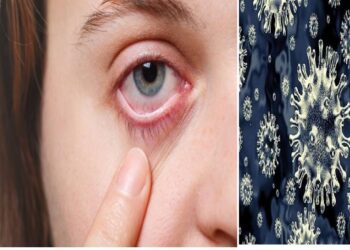 ब्लैक फंगस की बीमारी पूरे देश में लेकिन दवा पर्याप्त नहीं : डा. कुमार