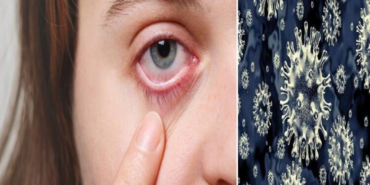 ब्लैक फंगस की बीमारी पूरे देश में लेकिन दवा पर्याप्त नहीं : डा. कुमार