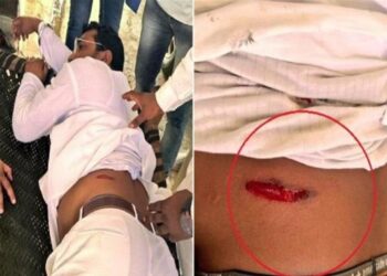 आजाद समाज पार्टी के अध्यक्ष चंद्रशेखर रावण पर जानलेवा हमला, अस्पताल में एडमिट