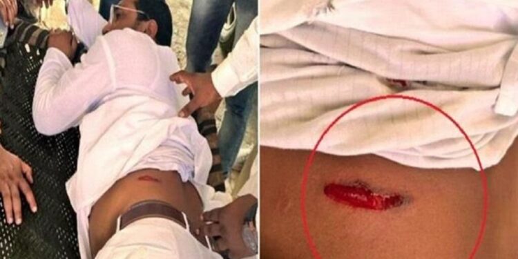 आजाद समाज पार्टी के अध्यक्ष चंद्रशेखर रावण पर जानलेवा हमला, अस्पताल में एडमिट